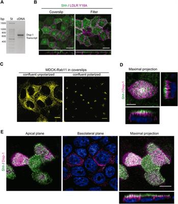 Sonic hedgehog is basolaterally sorted from the TGN and transcytosed to the apical domain involving Dispatched-1 at Rab11-ARE